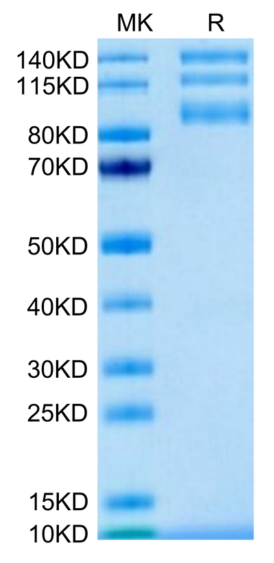 Biotinylated Human ITGAV&ITGB5 on Tris-Bis PAGE under reduced condition. The purity is greater than 95%.Biotinylated Human Integrin alpha V beta 5 (ITGAV&ITGB5) Heterodimer Protein, Active