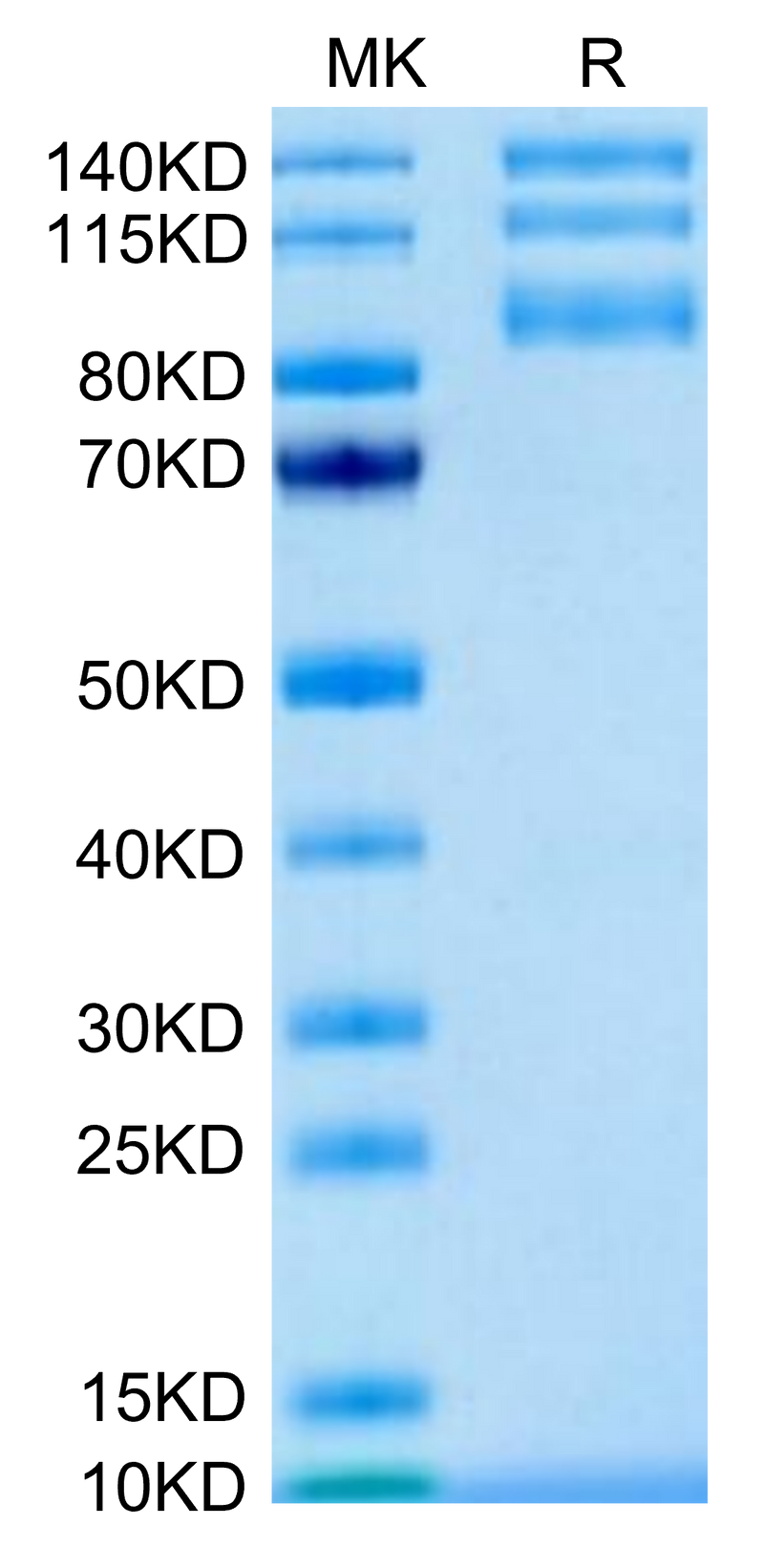 Biotinylated Human ITGAV&ITGB5 on Tris-Bis PAGE under reduced condition. The purity is greater than 95%.Biotinylated Human Integrin alpha V beta 5 (ITGAV&ITGB5) Heterodimer Protein, Active