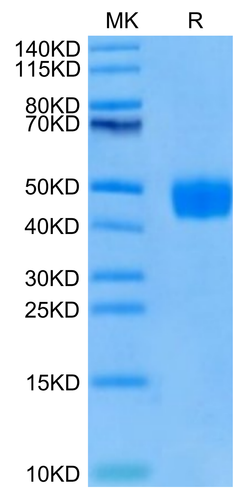 Cynomolgus BST1 on Tris-Bis PAGE under reduced condition. The purity is greater than 95%.Recombinant Cynomolgus BST1 Protein