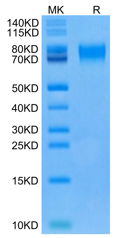 Human CD6 on Tris-Bis PAGE under reduced condition. The purity is greater than 95%.Recombinant Human CD6 Protein, Active