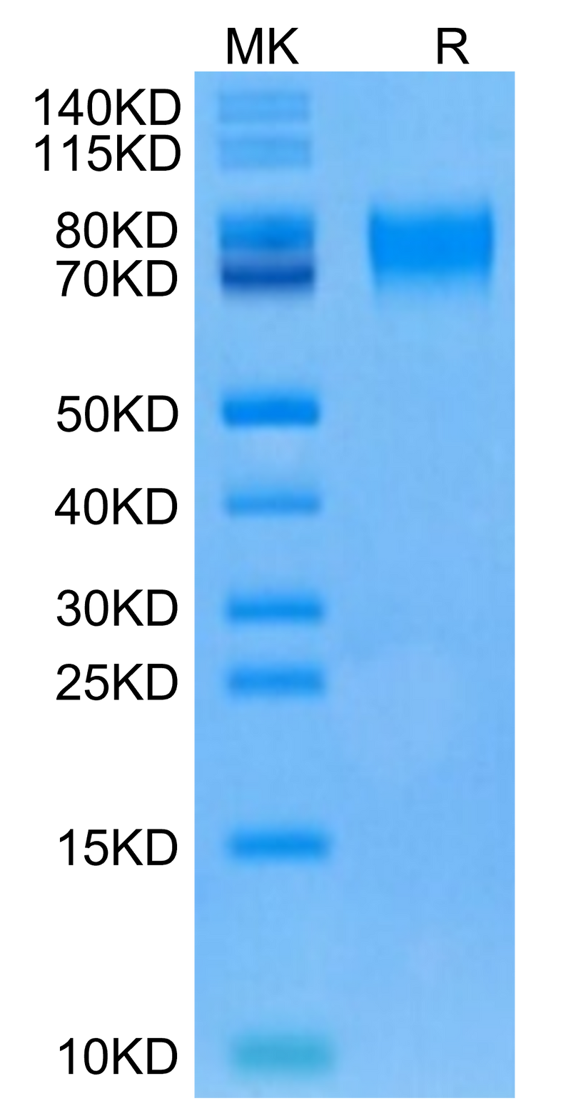 Human CD6 on Tris-Bis PAGE under reduced condition. The purity is greater than 95%.Recombinant Human CD6 Protein, Active
