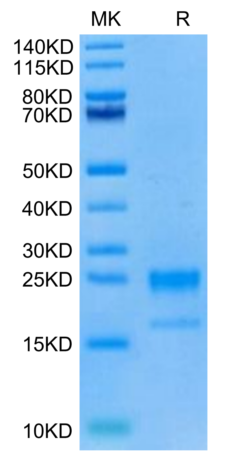 Cynomolgus GITR Ligand on Tris-Bis PAGE under reduced condition. The purity is greater than 95%.Recombinant Cynomolgus GITR Ligand/TNFSF18 Protein, Active