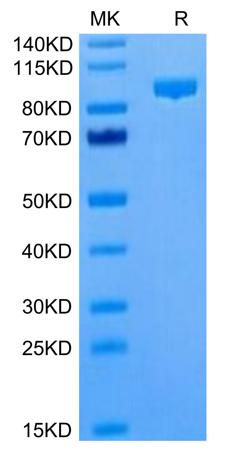 Cynomolgus Complement Component C2 on Tris-Bis PAGE under reduced condition. The purity is greater than 95%.Recombinant Cynomolgus Complement Component C2 Protein