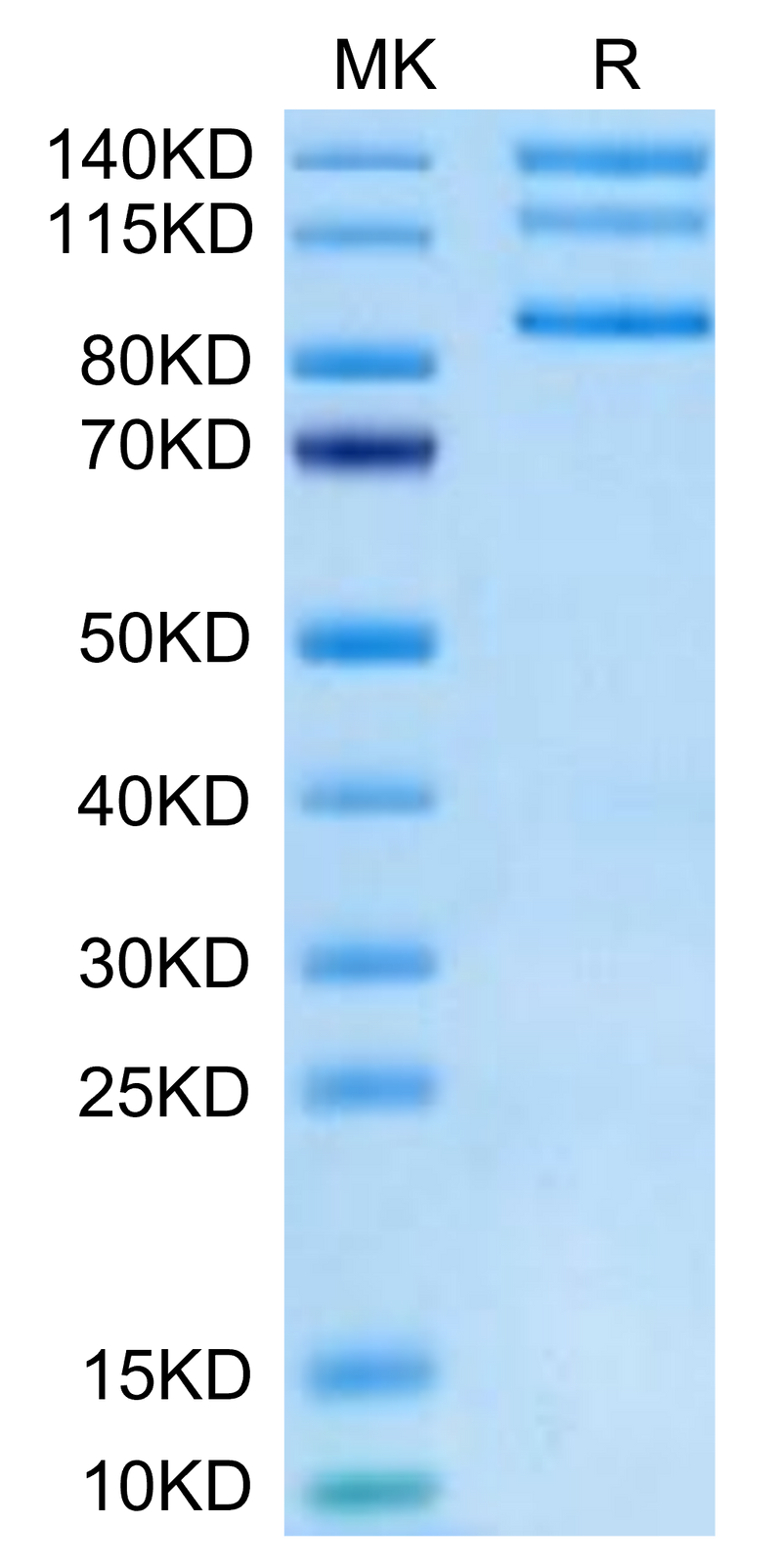 Biotinylated Human Integrin alpha V beta 8 (ITGAV&ITGB8) Heterodimer on Tris-Bis PAGE under reduced condition. The purity is greater than 95%.Biotinylated Human Integrin alpha V beta 8 (ITGAV&ITGB8) Heterodimer Protein, Active