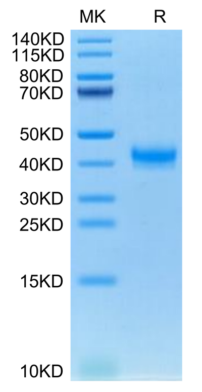 Cynomolgus CADM3 on Tris-Bis PAGE under reduced condition. The purity is greater than 95%.Recombinant Cynomolgus CADM3 Protein