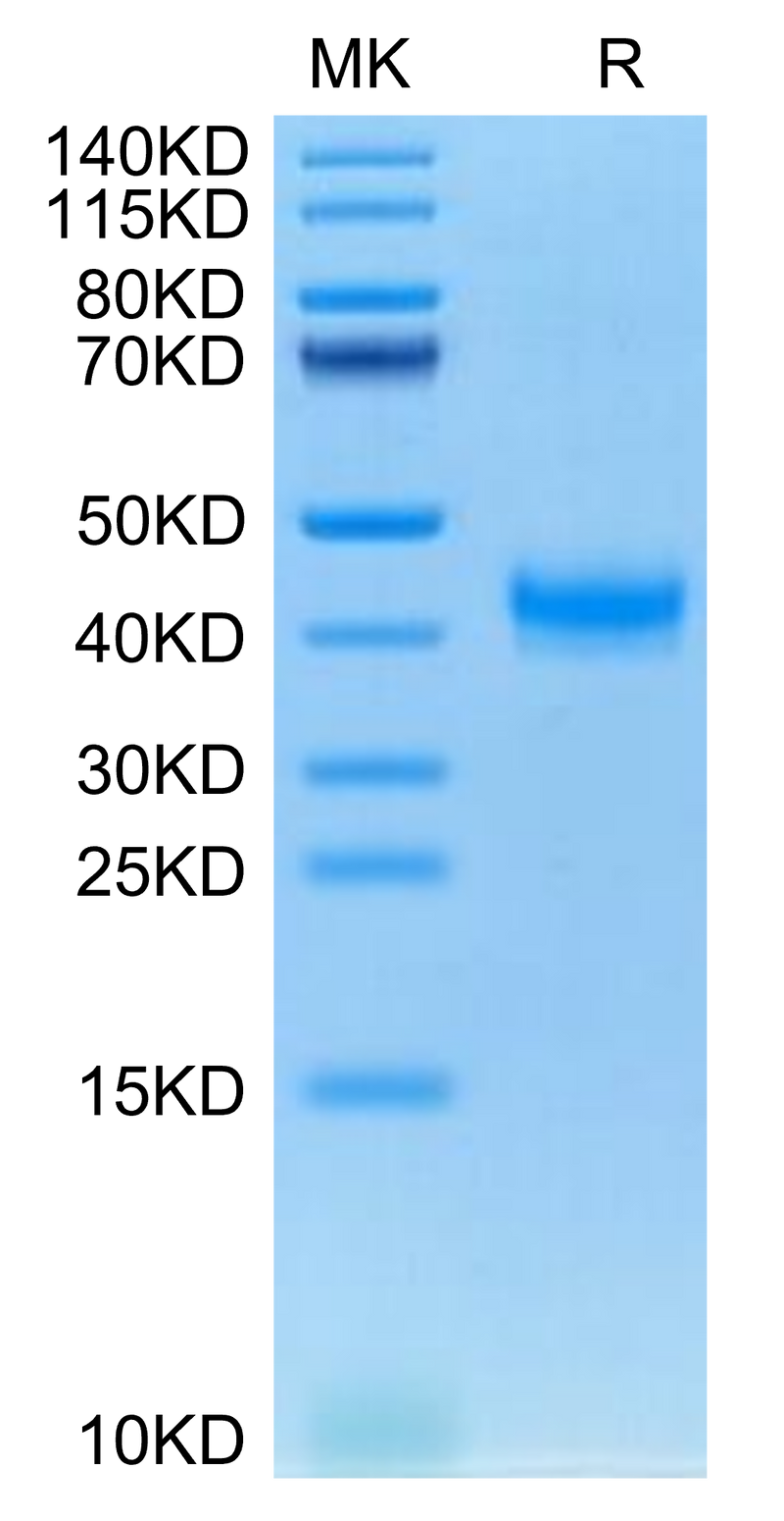 Cynomolgus CADM3 on Tris-Bis PAGE under reduced condition. The purity is greater than 95%.Recombinant Cynomolgus CADM3 Protein