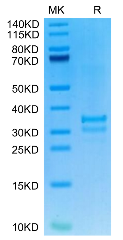 Mouse TNFSF15 on Tris-Bis PAGE under reduced condition. The purity is greater than 90%.Recombinant Mouse TNFSF15 Protein, Active