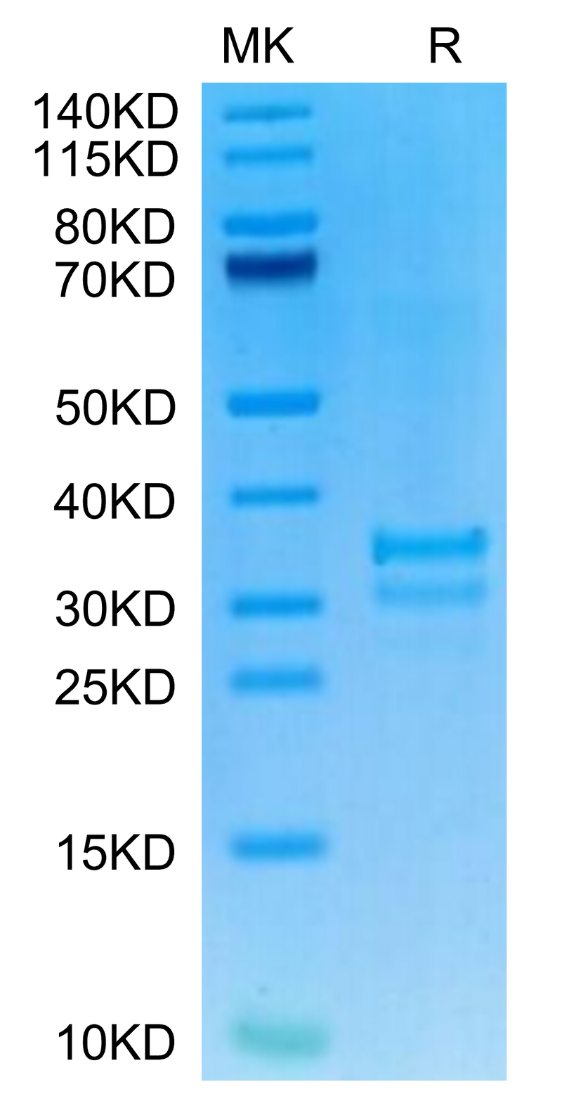 Mouse TNFSF15 on Tris-Bis PAGE under reduced condition. The purity is greater than 90%.Recombinant Mouse TNFSF15 Protein, Active