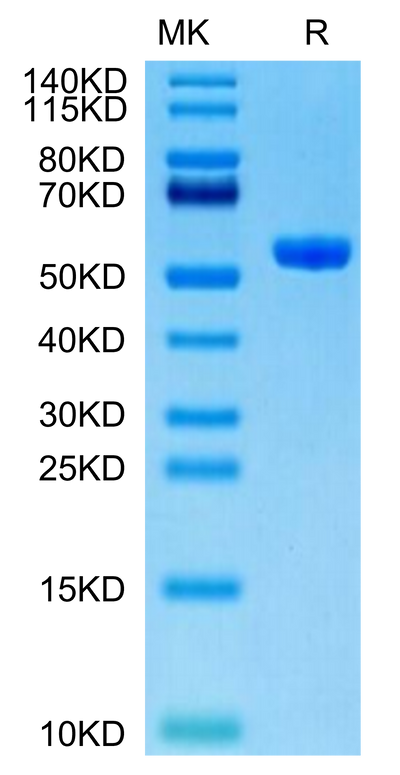 Human HLA-A*11:01&B2M&KRAS WT (VVVGAGGVGK) Monomer on Tris-Bis PAGE under reduced condition. The purity is greater than 95%.Recombinant Human HLA-A*11:01&B2M&KRAS WT (VVVGAGGVGK) Monomer Protein