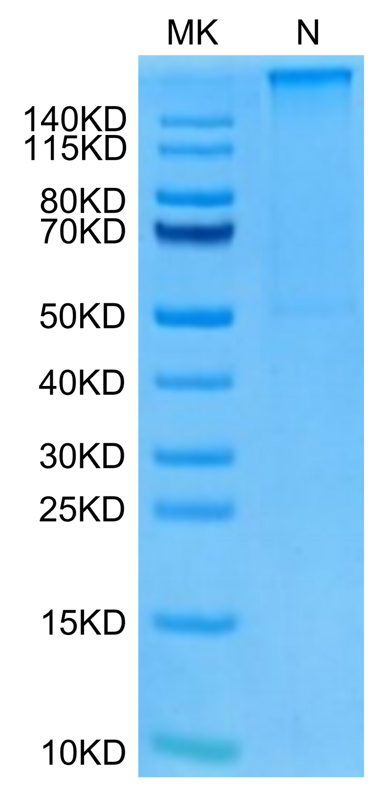 Human HLA-A*11:01&B2M&KRAS WT (VVVGAGGVGK) Tetramer on Tris-Bis PAGE under Non reducing (N) condition. The purity is greater than 95%.Recombinant Human HLA-A*11:01&B2M&KRAS WT (VVVGAGGVGK) Tetramer Protein