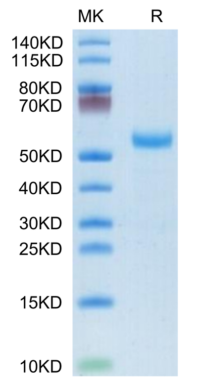 Rhesus macaque DLL3 on Tris-Bis PAGE under reduced condition. The purity is greater than 95%.Recombinant Rhesus macaque DLL3 Protein, Active