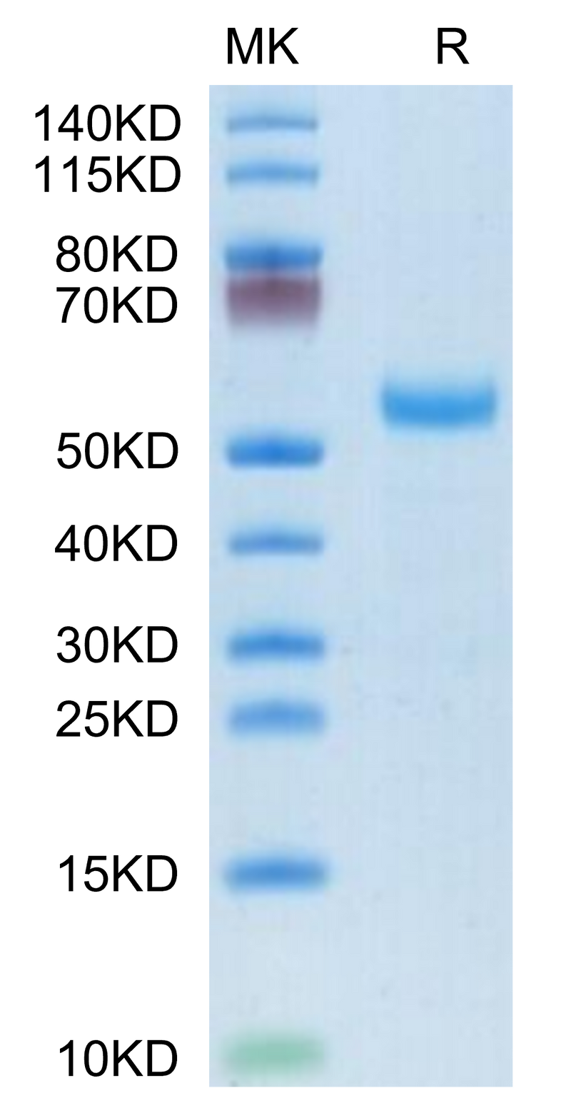 Rhesus macaque DLL3 on Tris-Bis PAGE under reduced condition. The purity is greater than 95%.Recombinant Rhesus macaque DLL3 Protein, Active