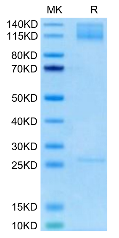 Biotinylated Human ITGA5&ITGB1 on Tris-Bis PAGE under reduced condition. The purity is greater than 95%.Biotinylated Human Integrin alpha 5 beta 1 (ITGA5&ITGB1) Heterodimer Protein, Active