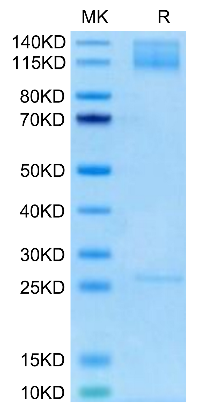 Biotinylated Human ITGA5&ITGB1 on Tris-Bis PAGE under reduced condition. The purity is greater than 95%.Biotinylated Human Integrin alpha 5 beta 1 (ITGA5&ITGB1) Heterodimer Protein, Active
