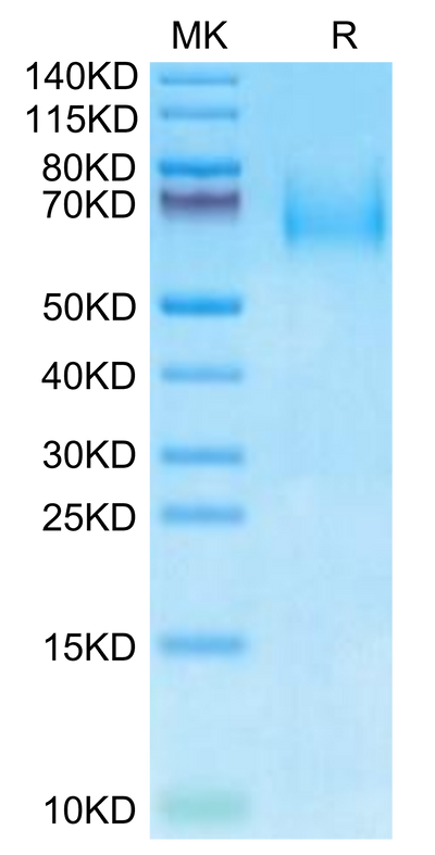Human IL-23R on Tris-Bis PAGE under reduced condition. The purity is greater than 95%.Recombinant Human IL-23R Protein, Active