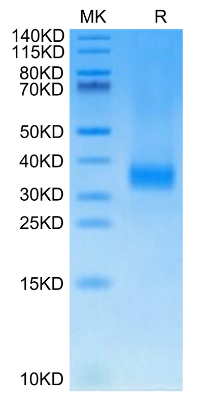 Cynomolgus SOST on Tris-Bis PAGE under reduced condition. The purity is greater than 95%.Recombinant Cynomolgus SOST/Sclerostin Protein, Active