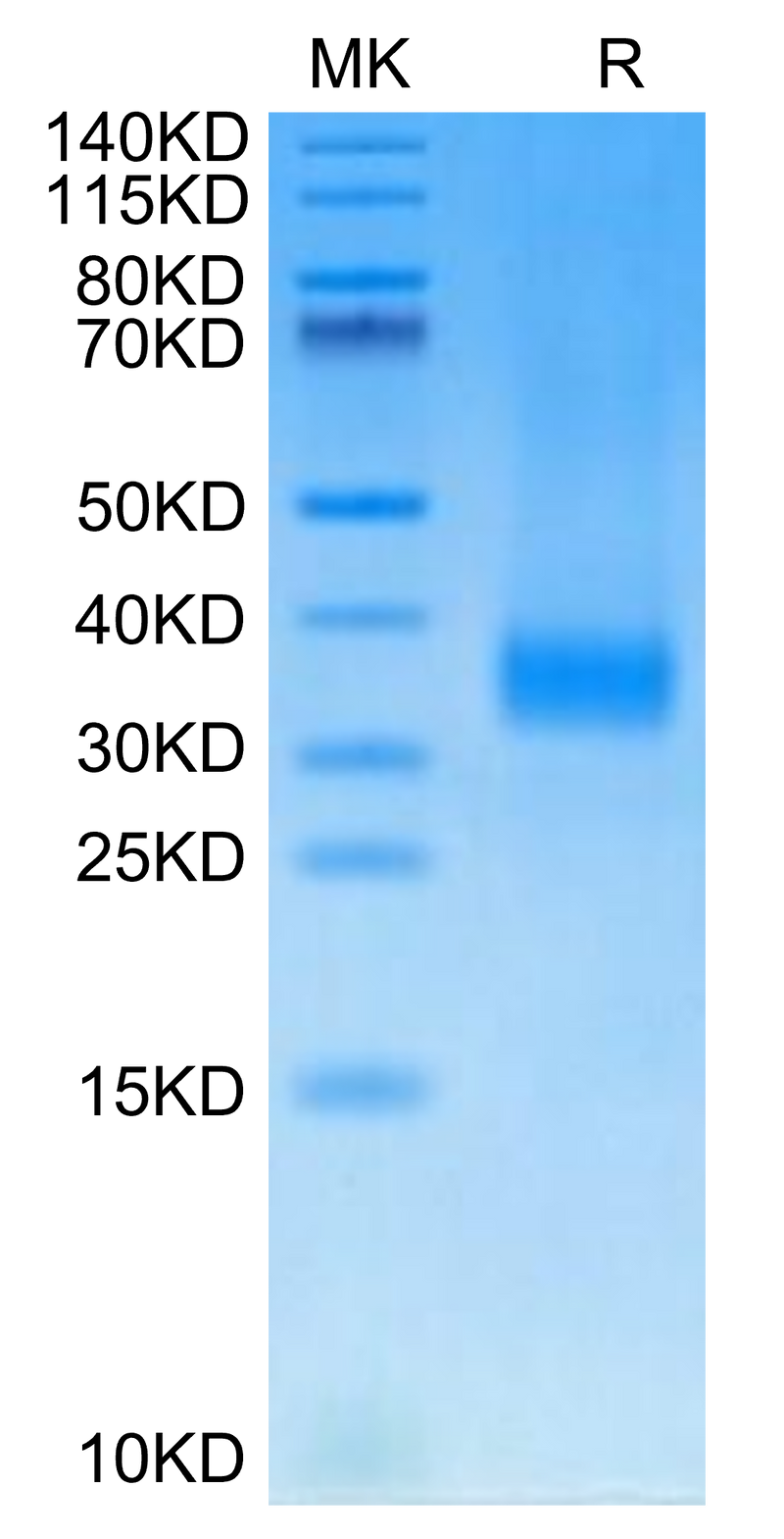 Cynomolgus SOST on Tris-Bis PAGE under reduced condition. The purity is greater than 95%.Recombinant Cynomolgus SOST/Sclerostin Protein, Active