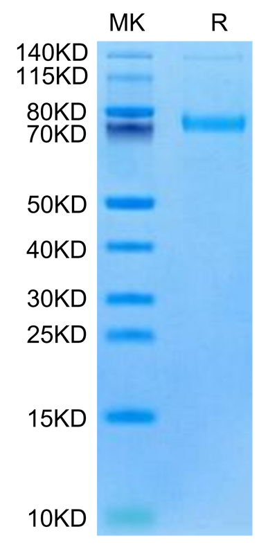 Cynomolgus/Rhesus macaque LRRC15 on Tris-Bis PAGE under reduced condition. The purity is greater than 95%.Recombinant Cynomolgus/Rhesus macaque LRRC15/LIB Protein, Active