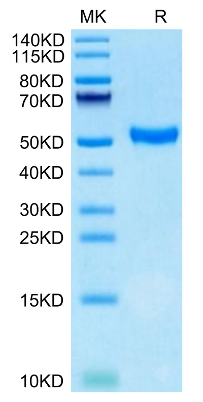 Human CD5 on Tris-Bis PAGE under reduced condition. The purity is greater than 95%.Recombinant Human CD5 Protein, Active