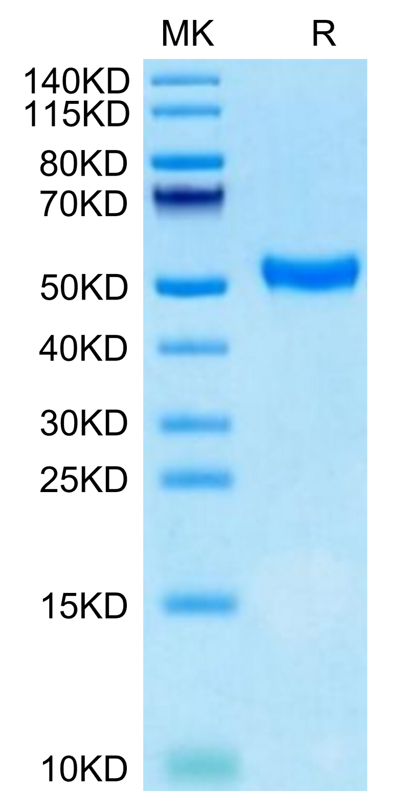 Human CD5 on Tris-Bis PAGE under reduced condition. The purity is greater than 95%.Recombinant Human CD5 Protein, Active