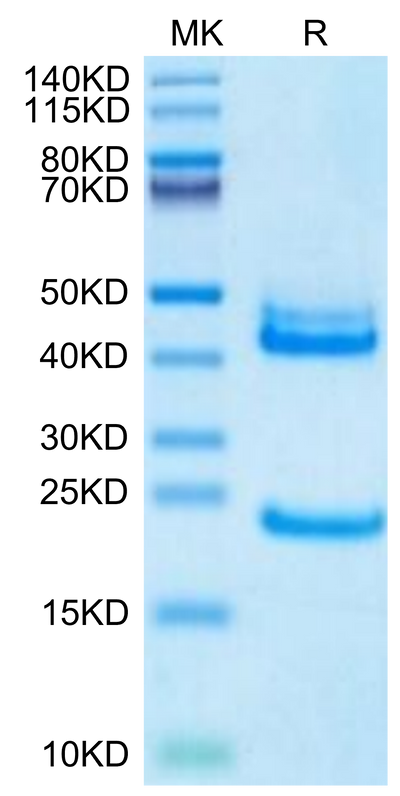Biotinylated Human IL-23 alpha&IL-12 beta on Tris-Bis PAGE under reduced condition. The purity is greater than 95%.Biotinylated Human IL-23 alpha&IL-12 beta Protein, Active