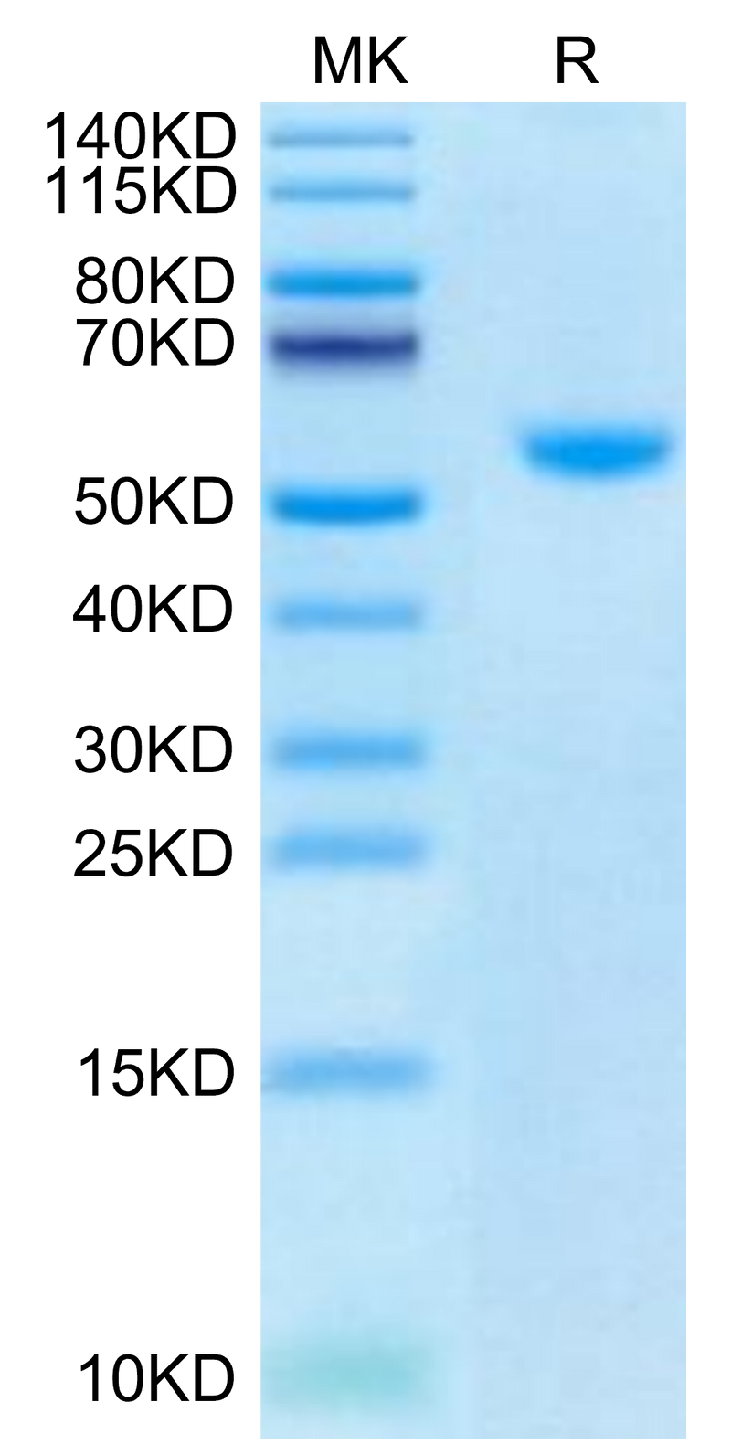 Biotinylated Human CD40 Ligand Trimer on Tris-Bis PAGE under reduced condition. The purity is greater than 95%.Biotinylated Human CD40 Ligand/TNFSF5 Trimer Protein (Primary Amine Labeling), Active