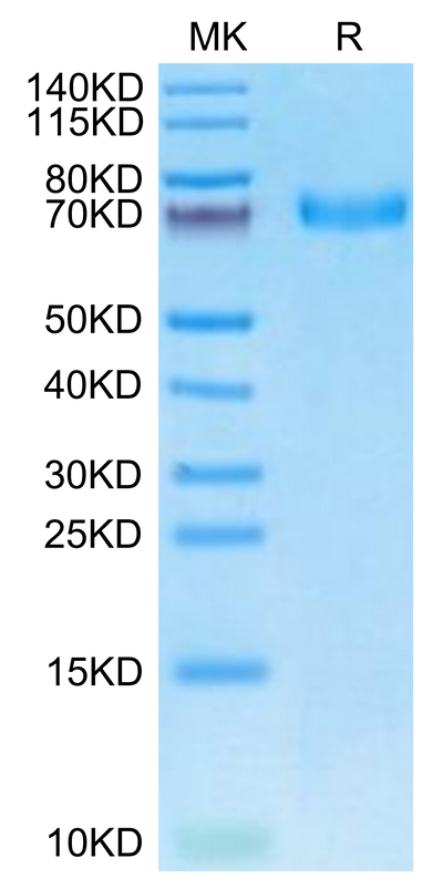 Cynomolgus EPHA5 on Tris-Bis PAGE under reduced condition. The purity is greater than 95%.Recombinant Cynomolgus EPHA5 Protein