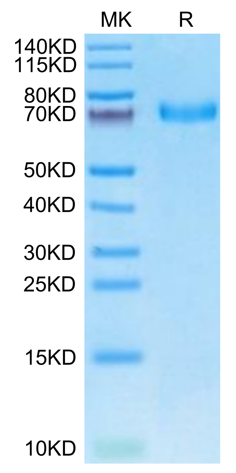 Cynomolgus EPHA5 on Tris-Bis PAGE under reduced condition. The purity is greater than 95%.Recombinant Cynomolgus EPHA5 Protein