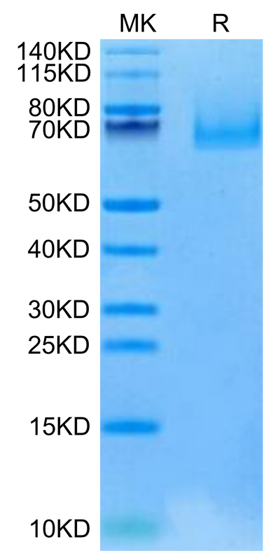 Cynomolgus EPHA10 on Tris-Bis PAGE under reduced condition. The purity is greater than 95%.Recombinant Cynomolgus EPHA10 Protein
