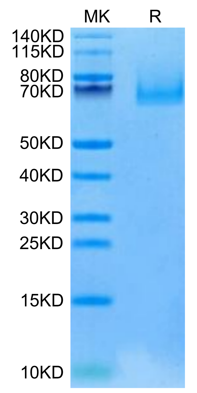 Cynomolgus EPHA10 on Tris-Bis PAGE under reduced condition. The purity is greater than 95%.Recombinant Cynomolgus EPHA10 Protein
