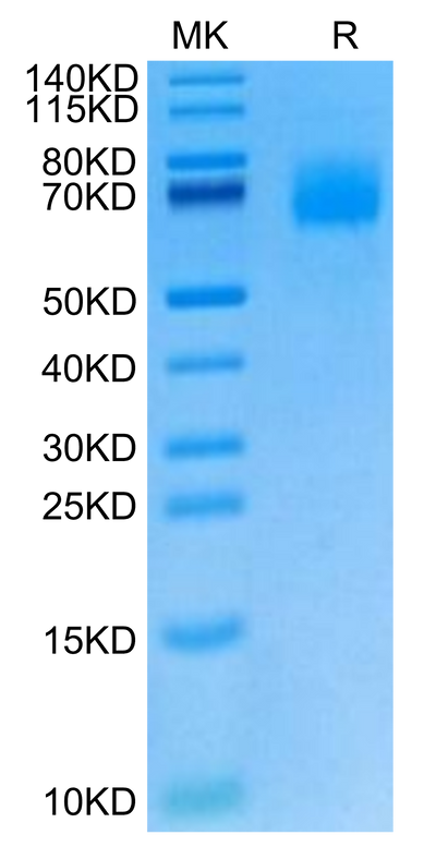 Cynomolgus IL-23R on Tris-Bis PAGE under reduced condition. The purity is greater than 95%.Recombinant Cynomolgus IL-23R Protein, Active