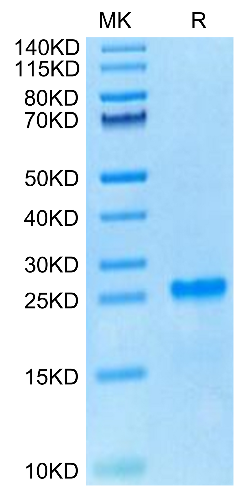 Cynomolgus PS20 on Tris-Bis PAGE under reduced condition. The purity is greater than 95%.Recombinant Cynomolgus PS20 Protein
