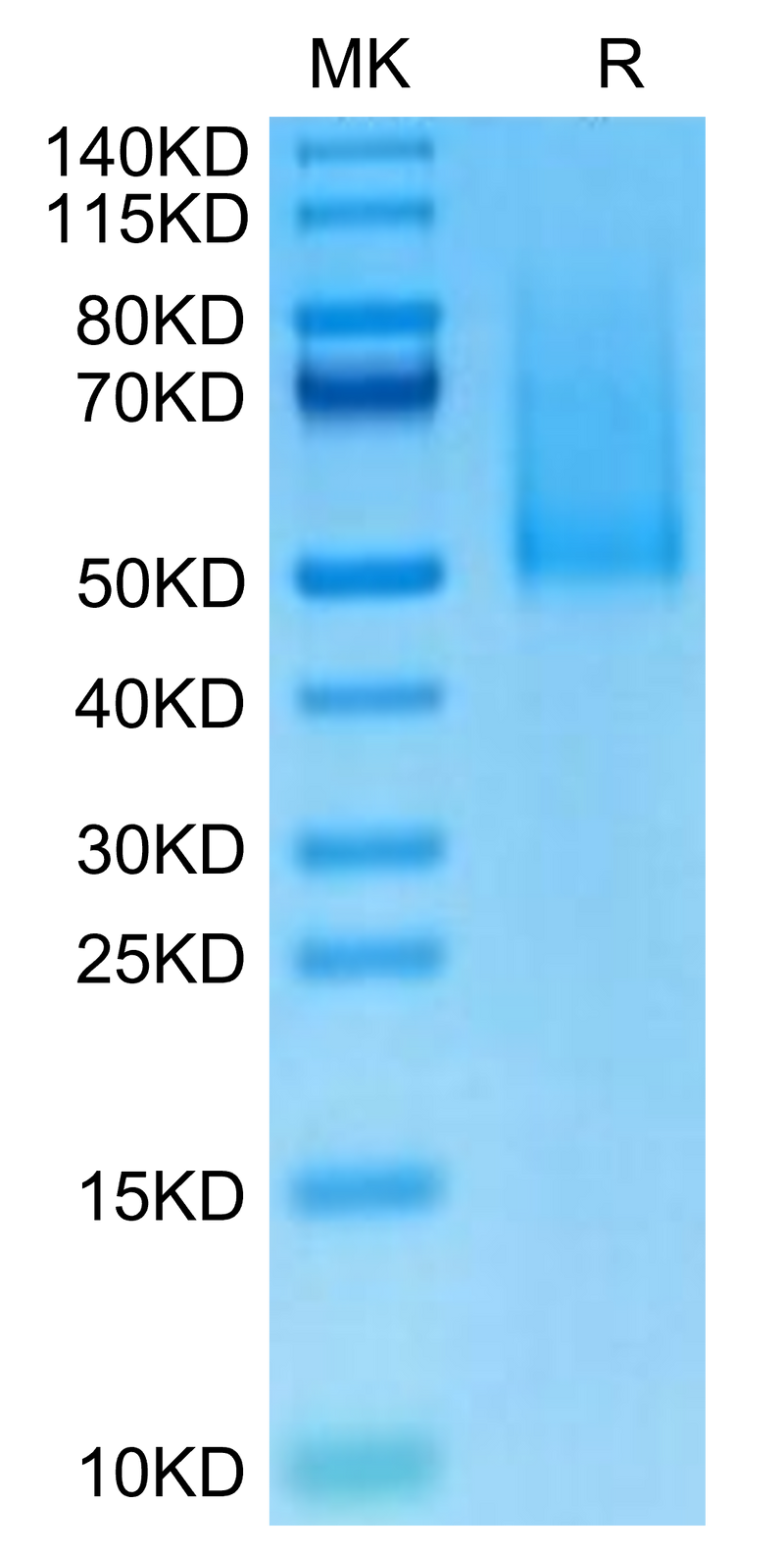 Cynomolgus CX3CL1 on Tris-Bis PAGE under reduced condition. The purity is greater than 95%.Recombinant Cynomolgus CX3CL1/Fractalkine Protein