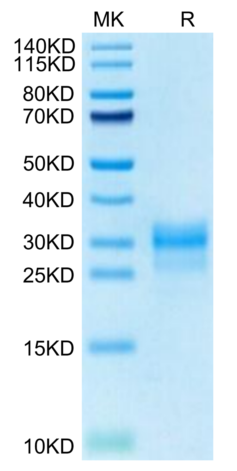 Cynomolgus IL-1 alpha on Tris-Bis PAGE under reduced condition. The purity is greater than 95%.Recombinant Cynomolgus IL-1 alpha/IL-1A Protein