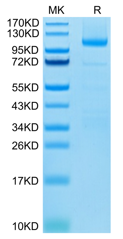 Human LGR-5 on Tris-Bis PAGE under reduced condition. The purity is greater than 95%.Recombinant Human LGR-5 Protein, Active