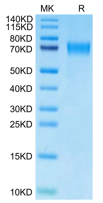 Mouse CD39 on Tris-Bis PAGE under reduced condition. The purity is greater than 95%.Recombinant Mouse CD39/ENTPD1 Protein