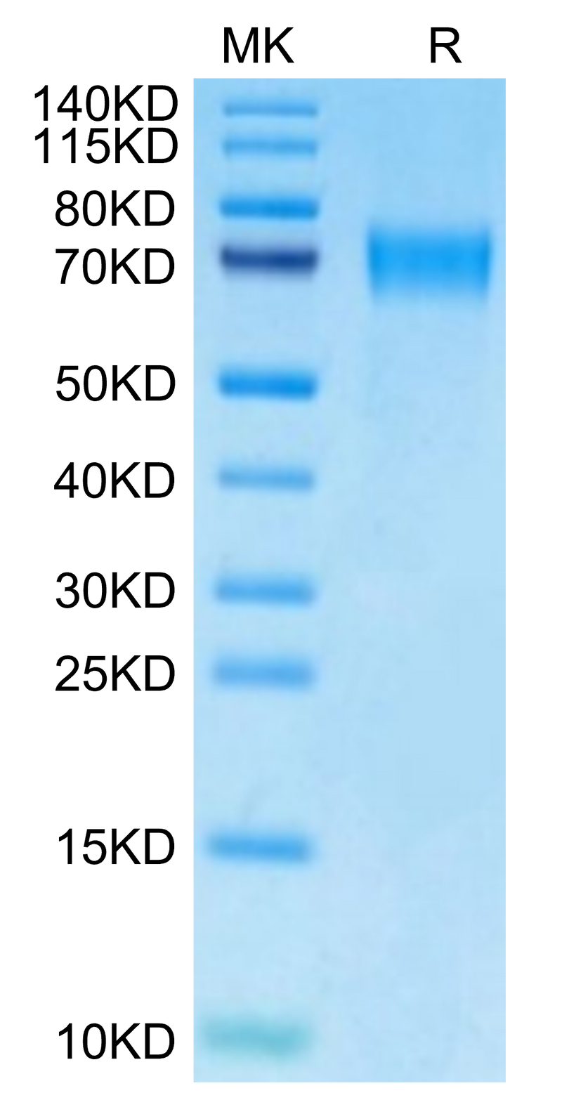 Mouse CD39 on Tris-Bis PAGE under reduced condition. The purity is greater than 95%.Recombinant Mouse CD39/ENTPD1 Protein
