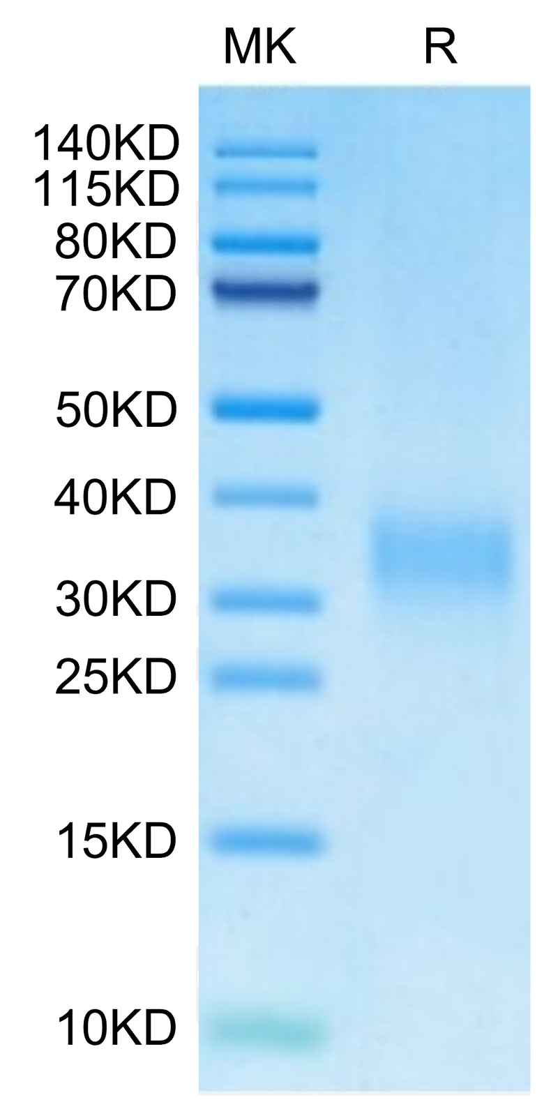 Mouse PGF on Tris-Bis PAGE under reduced condition. The purity is greater than 95%.Recombinant Mouse PGF Protein