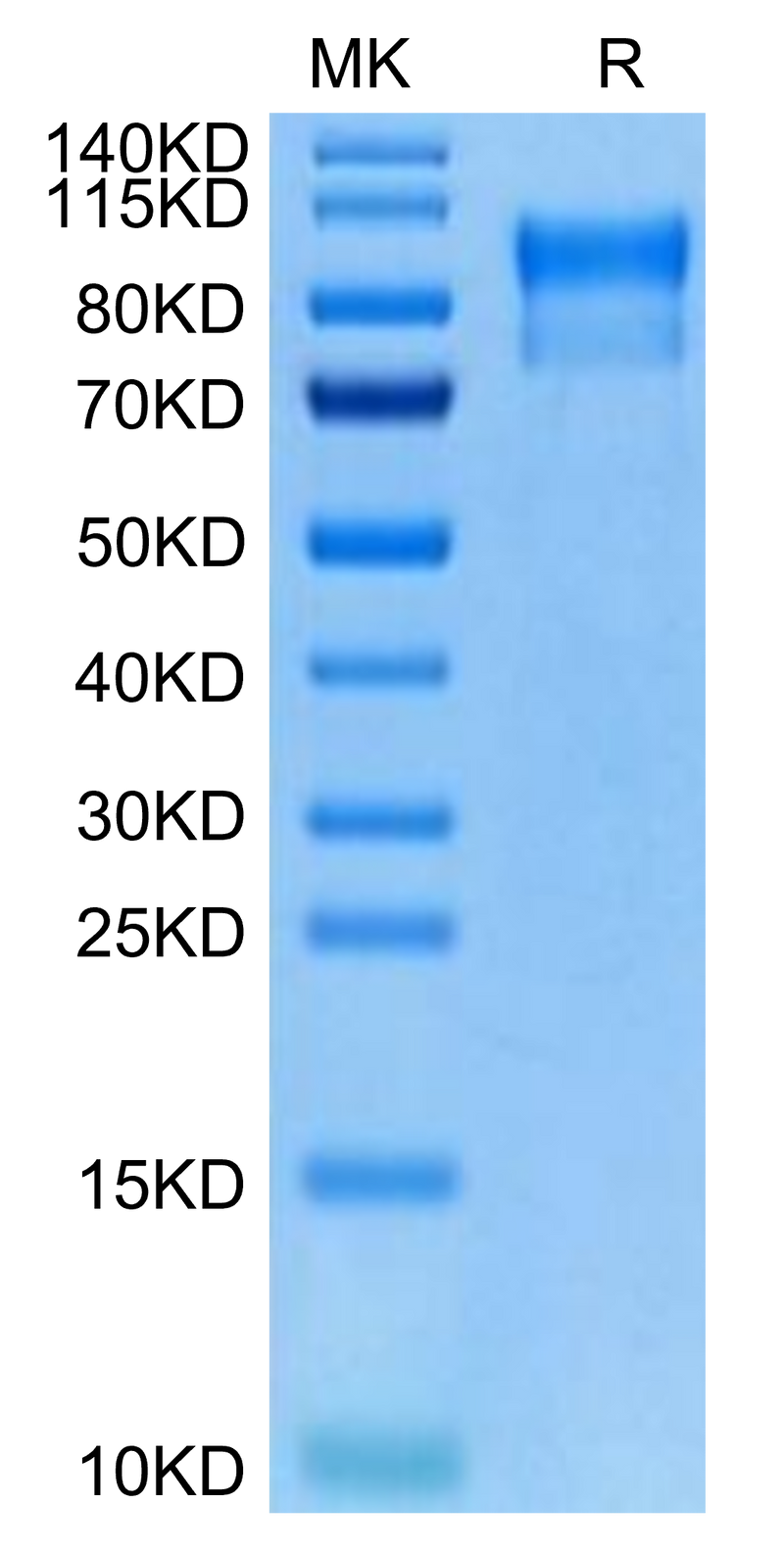 Biotinylated Human Her4 on Tris-Bis PAGE under reduced condition. The purity is greater than 95%.Biotinylated Human Her4/ErbB4 Protein, Active
