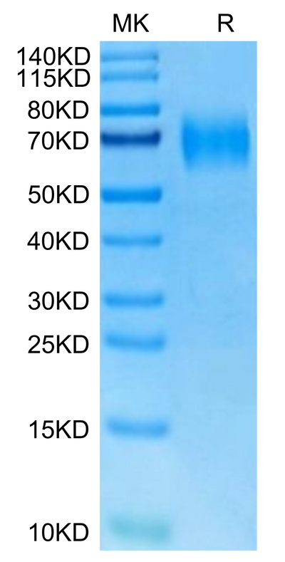Mouse IL-23R on Tris-Bis PAGE under reduced condition. The purity is greater than 95%.Recombinant Mouse IL-23R Protein, Active