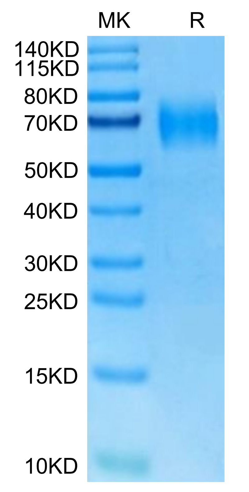 Mouse IL-23R on Tris-Bis PAGE under reduced condition. The purity is greater than 95%.Recombinant Mouse IL-23R Protein, Active