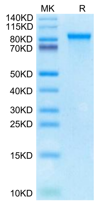 Cynomolgus MMP-9 on Tris-Bis PAGE under reduced condition. The purity is greater than 95%.Recombinant Cynomolgus MMP-9 Protein, Active