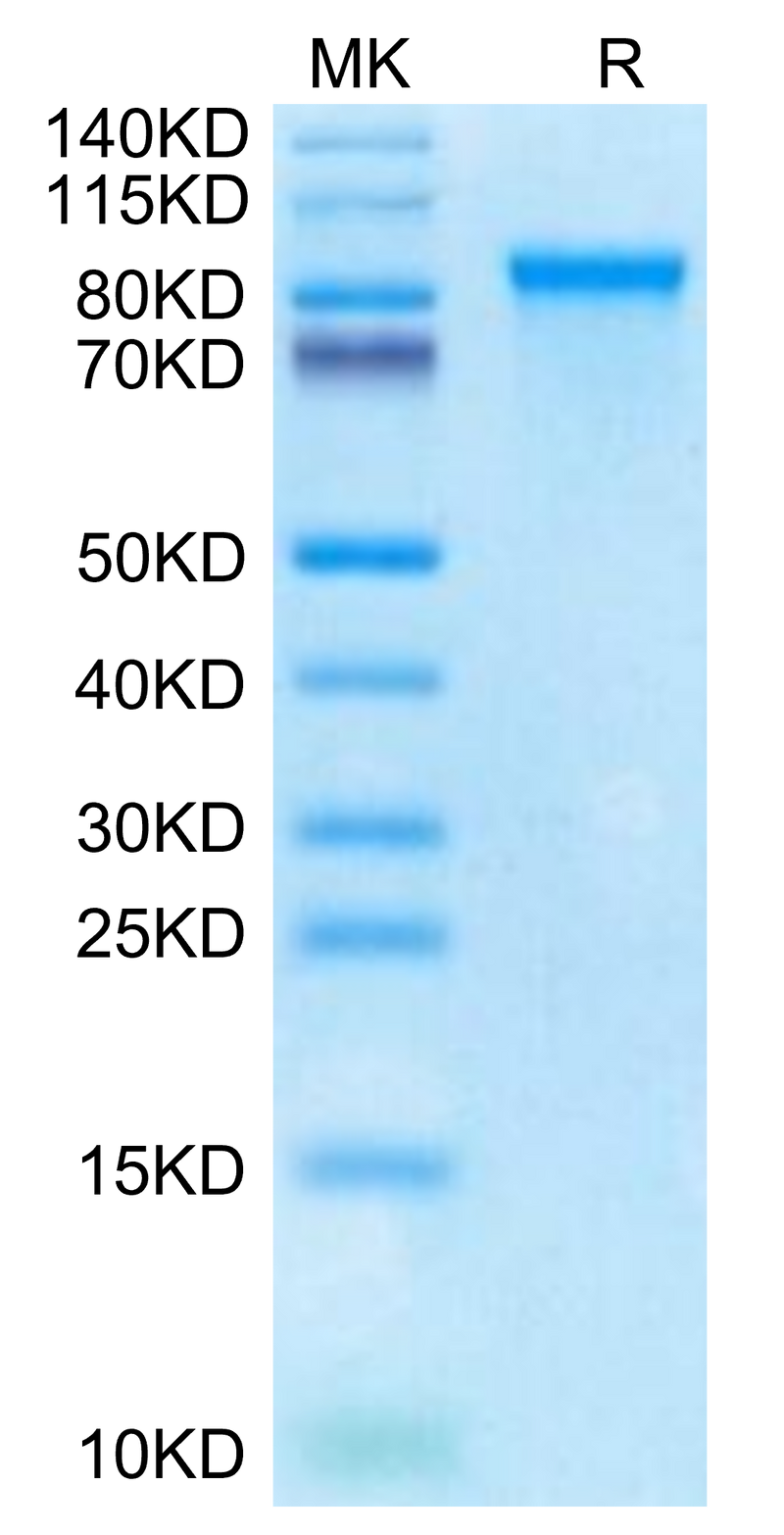 Cynomolgus MMP-9 on Tris-Bis PAGE under reduced condition. The purity is greater than 95%.Recombinant Cynomolgus MMP-9 Protein, Active