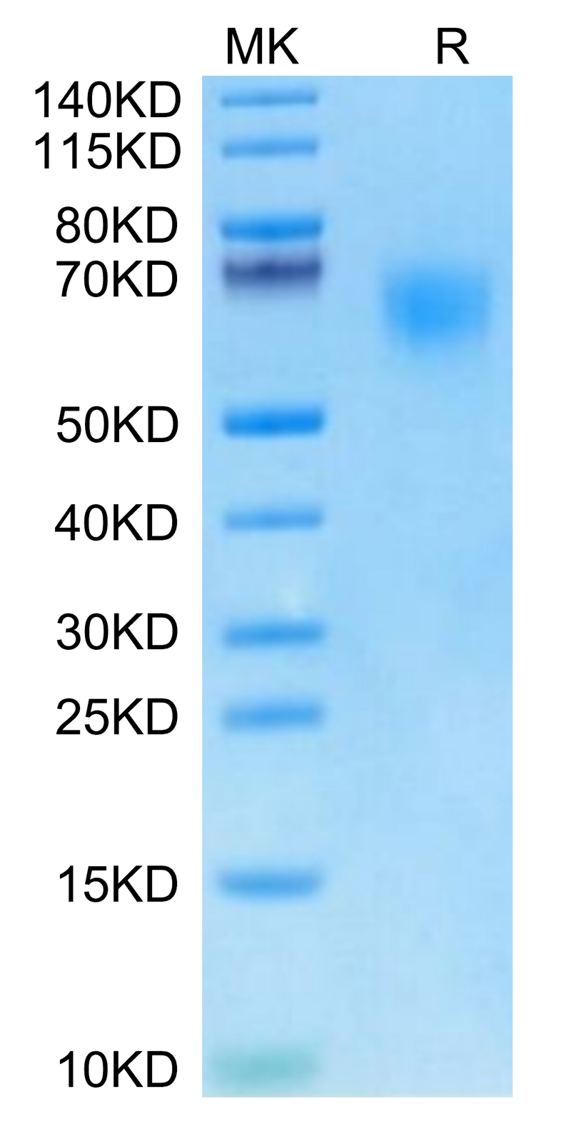 Cynomolgus TPBG on Tris-Bis PAGE under reduced condition. The purity is greater than 95%.Recombinant Cynomolgus TPBG/5T4 Protein, Active