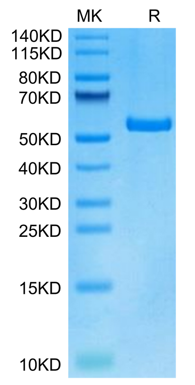 Human HLA-A*01:01&B2M&DSG3 (YTDNWLAVY) Monomer on Tris-Bis PAGE under reduced condition. The purity is greater than 95%.Recombinant Human HLA-A*01:01&B2M&DSG3 (YTDNWLAVY) Monomer Protein