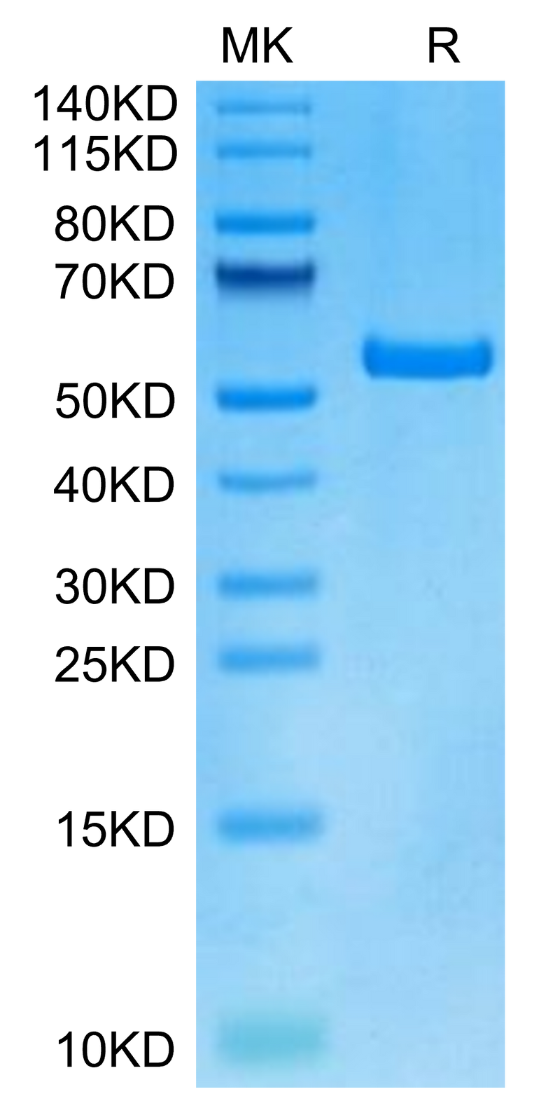 Human HLA-A*01:01&B2M&DSG3 (YTDNWLAVY) Monomer on Tris-Bis PAGE under reduced condition. The purity is greater than 95%.Recombinant Human HLA-A*01:01&B2M&DSG3 (YTDNWLAVY) Monomer Protein