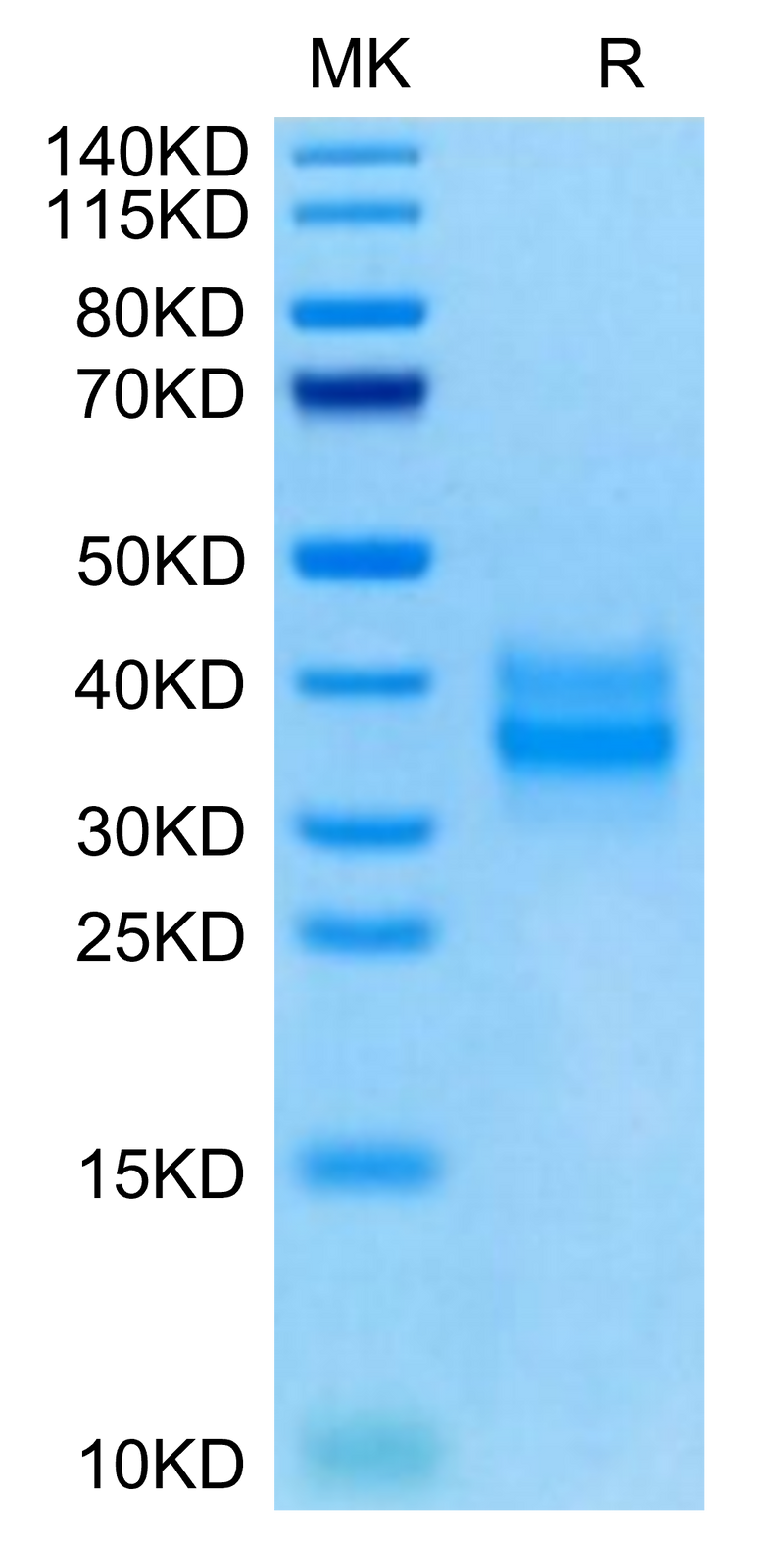 Mouse FOLR1 on Tris-Bis PAGE under reduced condition. The purity is greater than 95%.Recombinant Mouse FOLR1 Protein