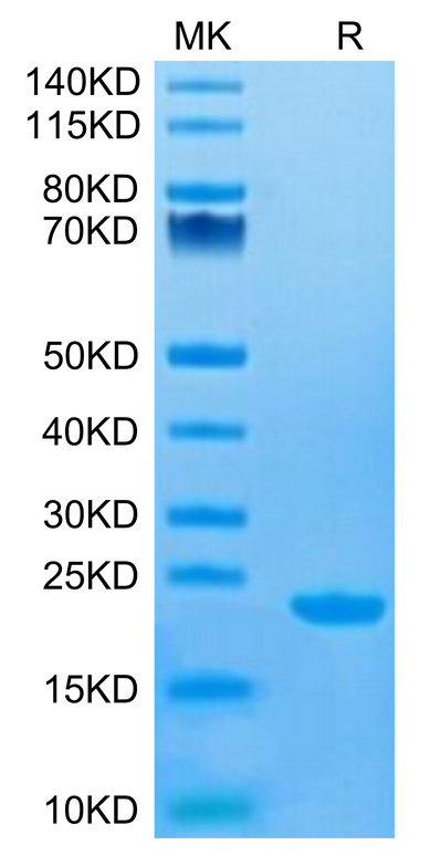 Human CD20 on Tris-Bis PAGE under reduced condition. The purity is greater than 95%.Recombinant Human CD20/MS4A1 Protein, Active