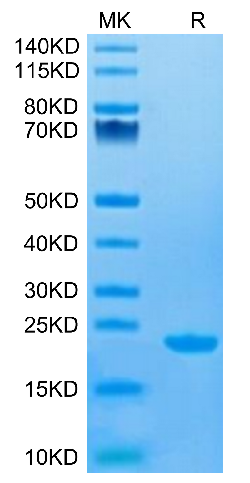 Human CD20 on Tris-Bis PAGE under reduced condition. The purity is greater than 95%.Recombinant Human CD20/MS4A1 Protein, Active