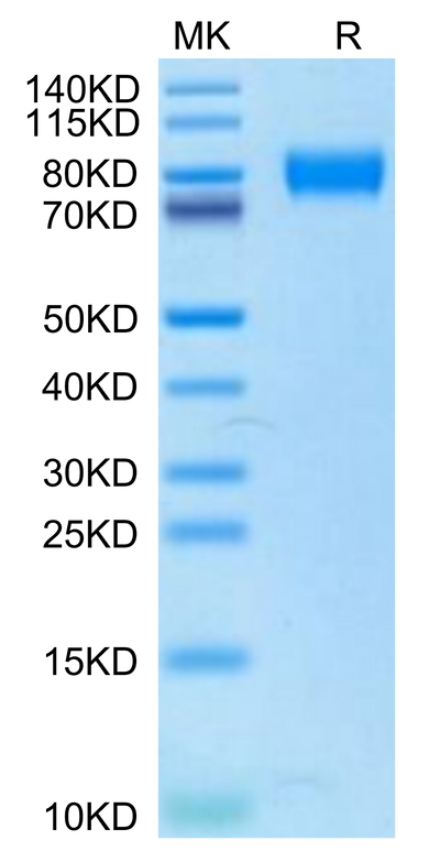 Human IL-2 R gamma on Tris-Bis PAGE under reduced condition. The purity is greater than 95%.Recombinant Human IL-2 R gamma/CD132 Protein